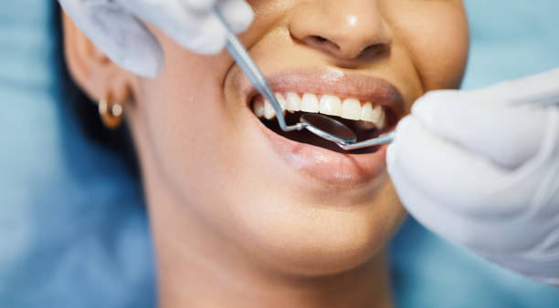 Best Dental Abscess Treatment in Vernonia, OR