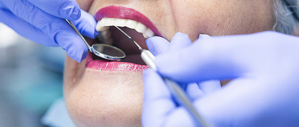 Best Emergency Root Canal Therapy in Vernonia, OR